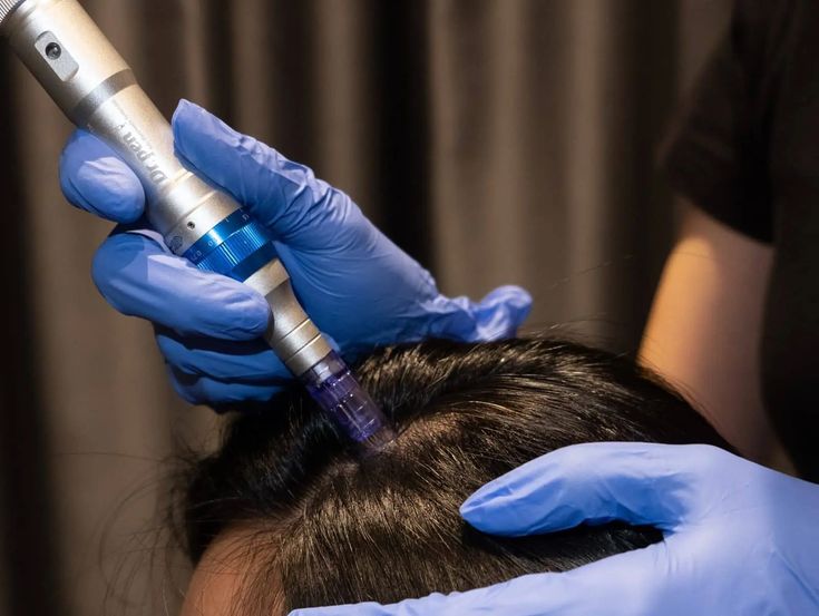 IV Infusion Hair Therapy